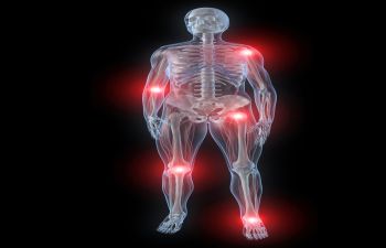 Joint Pain Inflammation